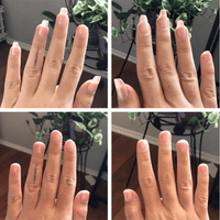 Stem Cells Nail Growth Pen