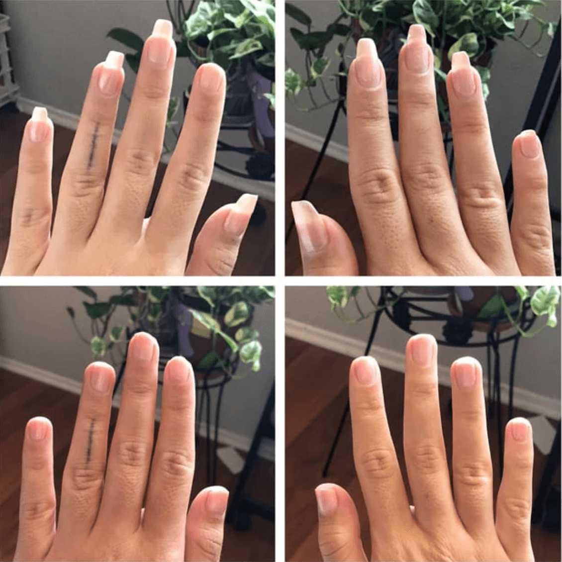 Stem Cells Nail Growth Pen