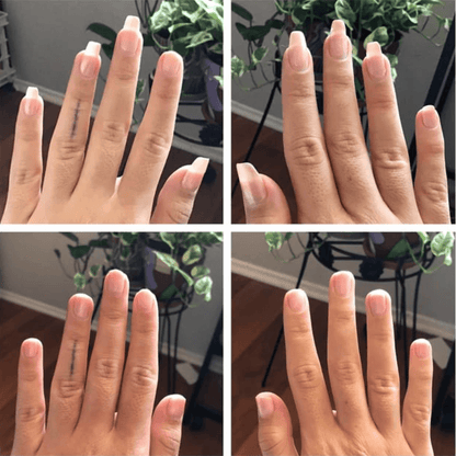 Stem Cells Nail Growth Pen