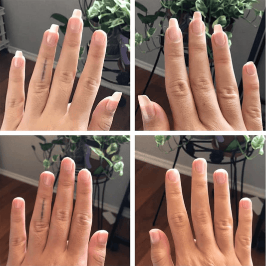 Stem Cells Nail Growth Pen